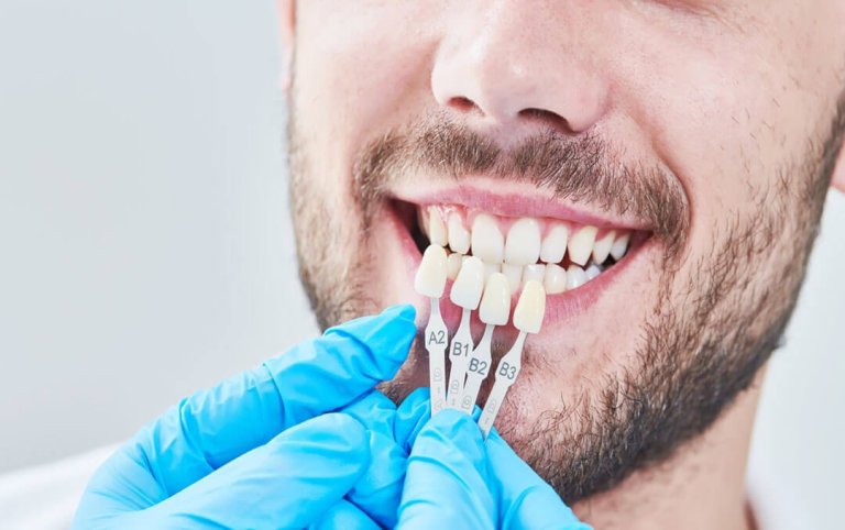 The Benefits of Dental Implants for Long-Term Oral Health